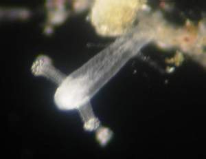 The Tiny Polyp of Cladonema